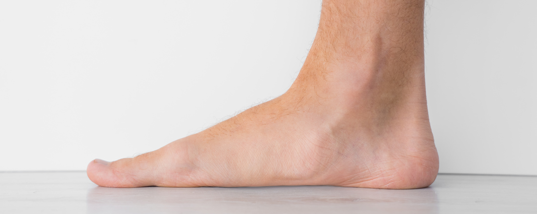 feet first - foot deformities